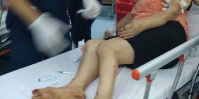 Cumhuriyetçi Kadınlar Derneği Başkanı Sevilay Kale Çete darp edilip kaçırıldı