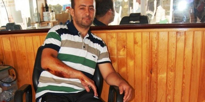 Evine giderken köpeklerin saldırısına uğradı