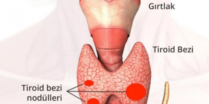 Hızlı kilo değişimi tiroidden olabilir