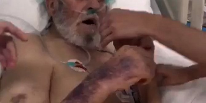 Yoğum Bakım hastasına sigara verip, dalga geçtiler