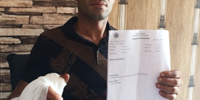 Alkol şişesi elinde patladı