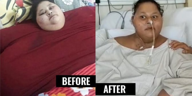 Dünyanın en şişman kadını hayatını kaybetti