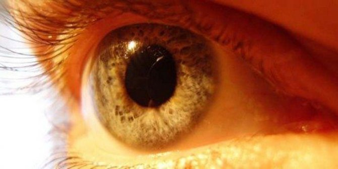 Sarı nokta hastalığı görme kaybı sebebi