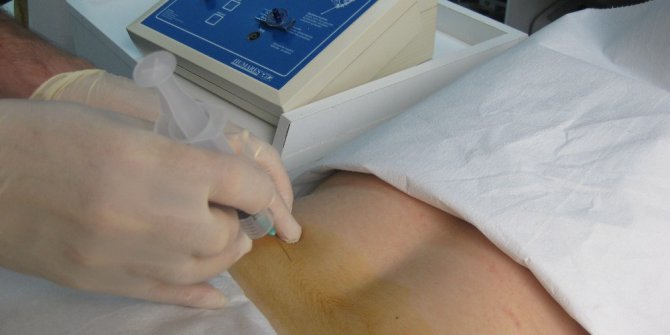 Bel ve boyun fıtıklarında ameliyatsız çözüm