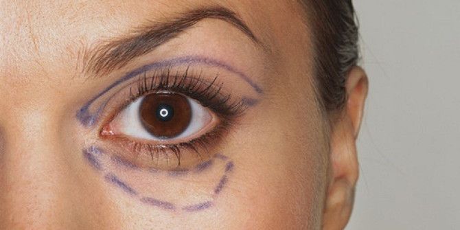 Göz Çevresi Sorunları Yaşlı Gösteriyor