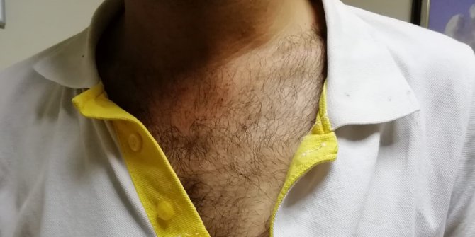 112 Personeline Yumruklu Şiddet