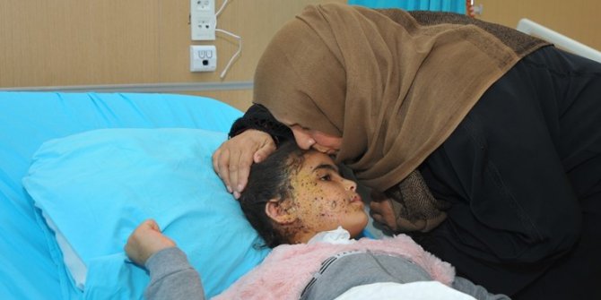 Bebek Katili Pkk/ypg’nin Bahçeye Tuzakladığı Eyp İki Küçük Çocuğu Yaraladı