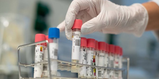 Koronavirüs tedavisi bulundu İddiası!