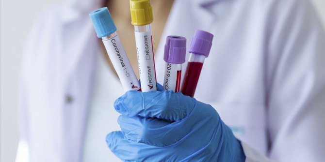 Pandemi hastanesi nedir, hangi hastaneler ‘pandemi hastanesi’ oldu.