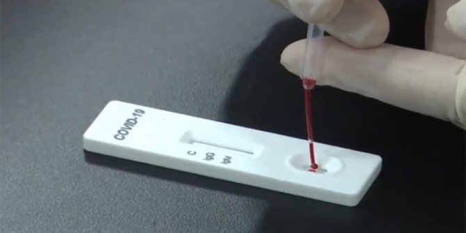 Yeni koronavirüs kiti 15 dakikada sonuç verecek