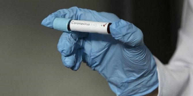 Japon bilim insanları, koronavirüs hava yoluyla bulaşıyor!