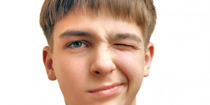 Turet Sendromu nedir, Turet sendromu belirtileri nelerdir, Turet sendromu kimlerde görülür?