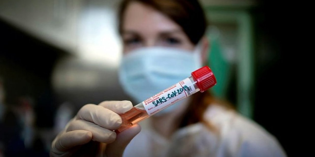 Koronavirüsün 3 yeni belirtisi daha ortaya çıktı