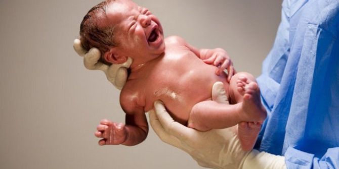 Riskli Bebeklerde Erken Müdahale