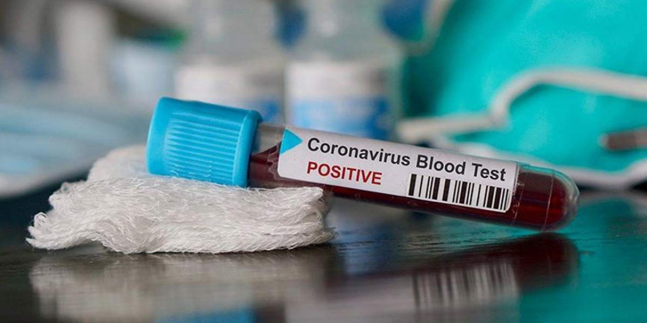 Kovid-19 salgınına karşı en riskli kan grubu hangisi?