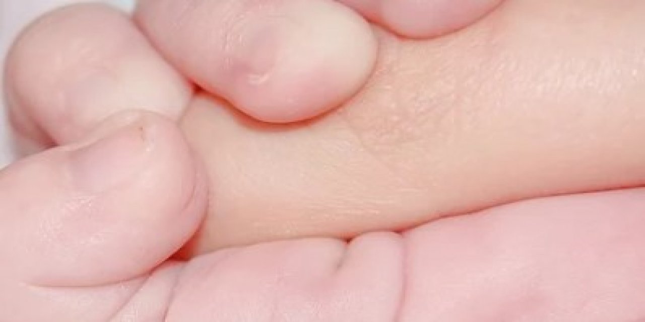 Böbrek Hastası Bebek Sağlığına Kavuştu