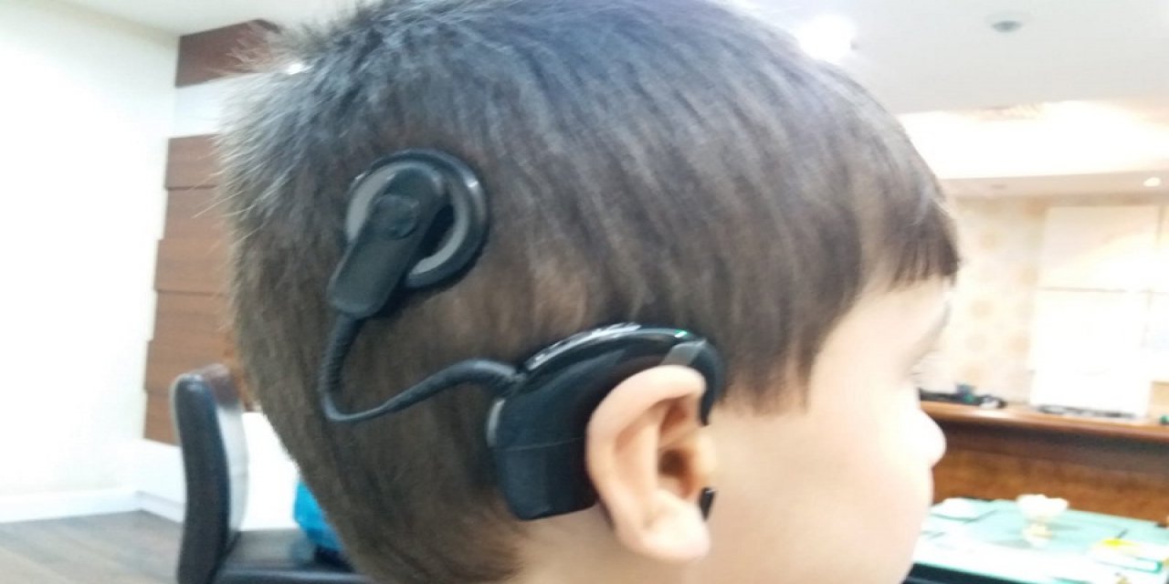 Patlamada İşitmesini Yitiren Hasan Biyonik Kulak İle Duyuyor