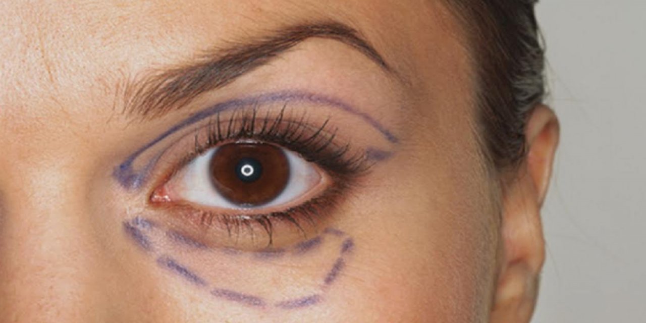 Göz Çevresi Estetiği Gençleştiriyor!