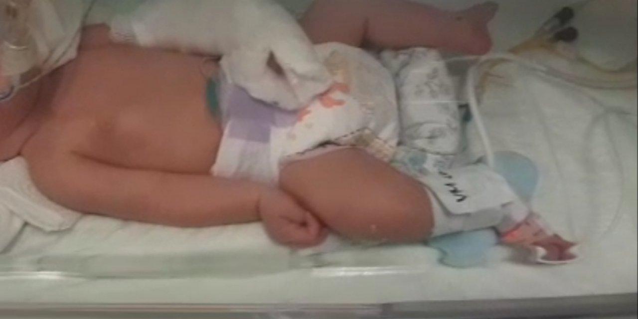 Bebeğin Doğumda Kolu Kırıldı İddiası