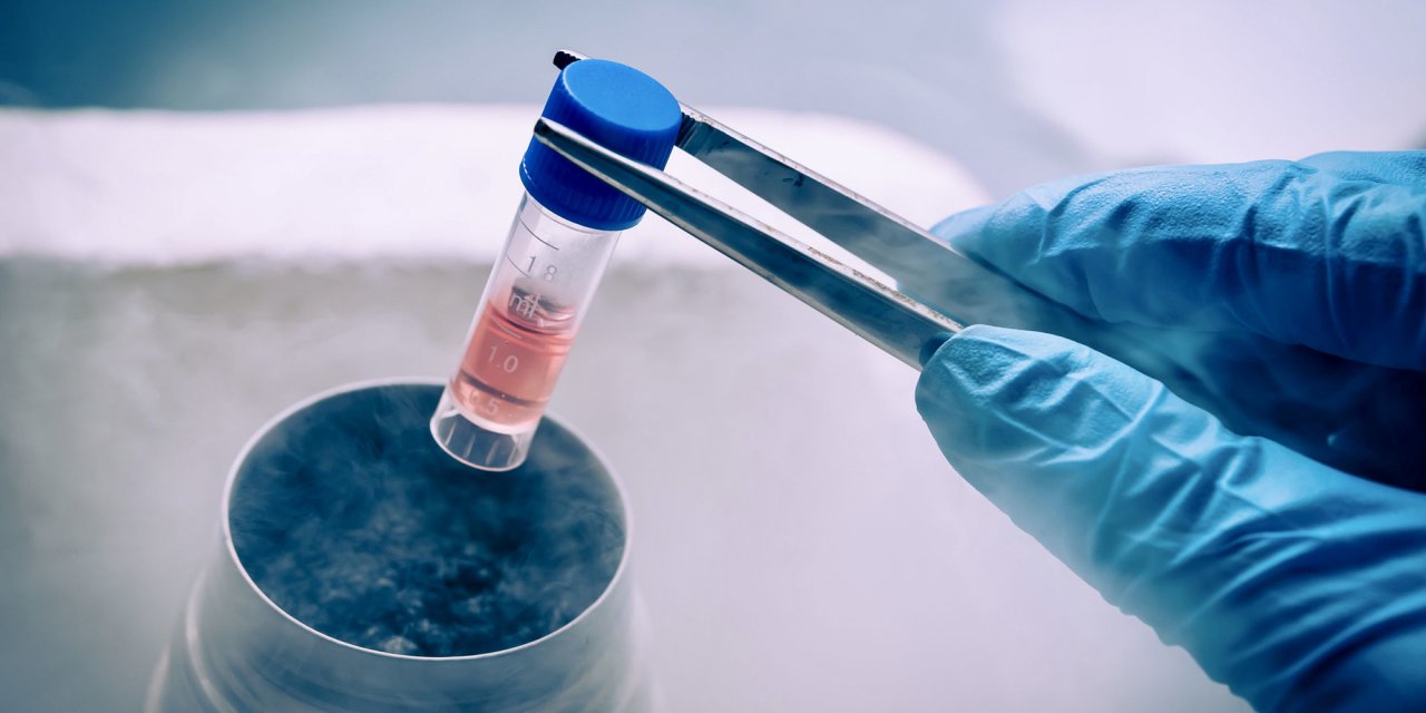 Türkiye Kök Hücre Araştırmasından Çarpıcı Sonuçlar Çıktı !