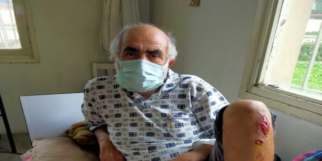 Bacağı Kesilen Palet Ustası Yardım Bekliyor