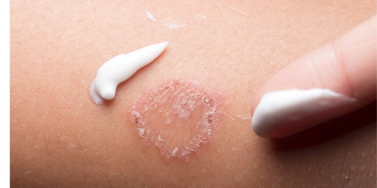 Saçkıran En Çok Gençleri Etkiliyor