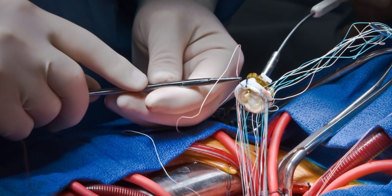 Sigara, Kalp Krizi Geçirme Riskini 8 Kat Artırıyor!