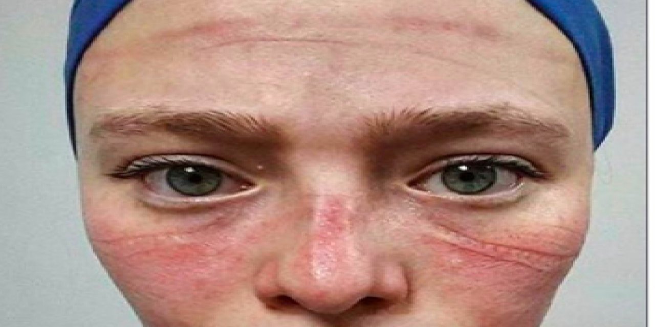 Sağlık Personelleri Verilen Sözlerin Tutulmasını İstiyor