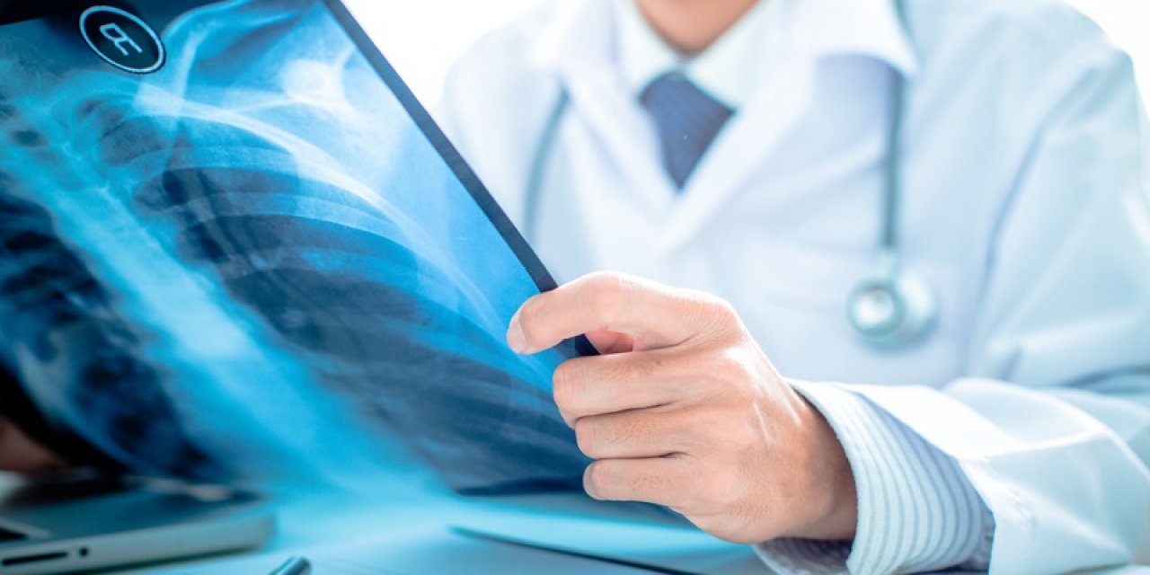 Akciğer Embolisi İyileşir Mi ?