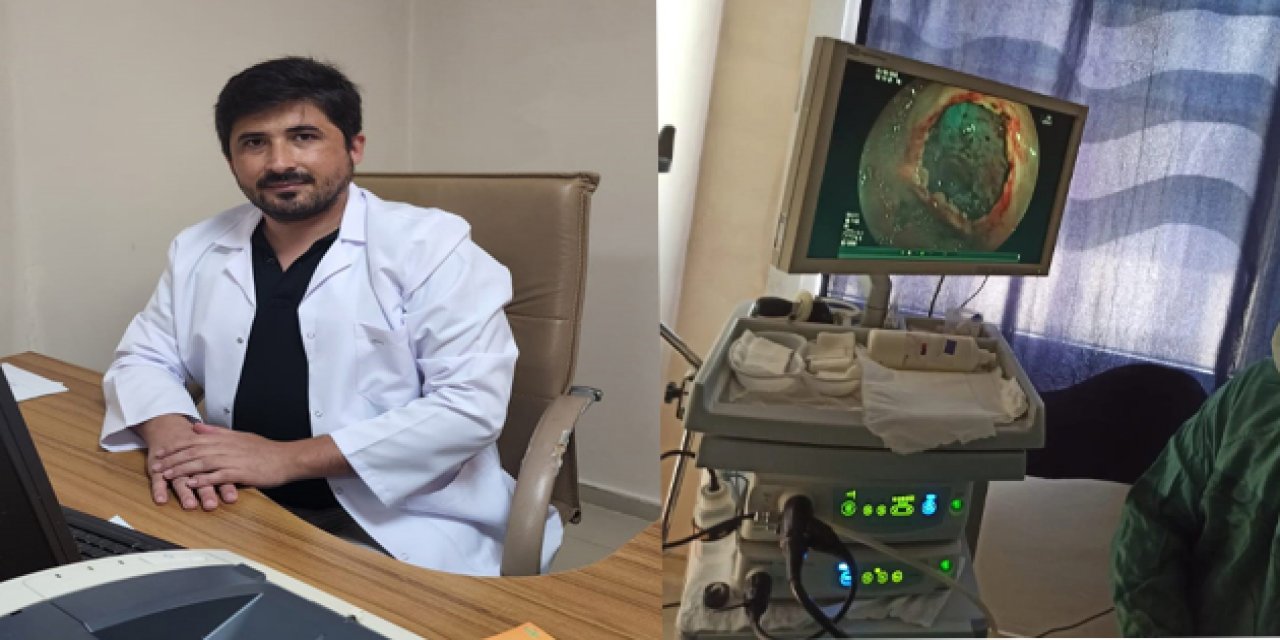 Mersin’de İlk Kez Kolon Kanserine Ameliyatsız Tedavi