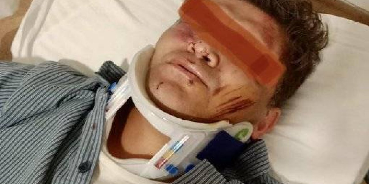 Aile Hekimi Sopalı Saldırıya Uğradı !!! (hayati Risk Devam Ediyor)