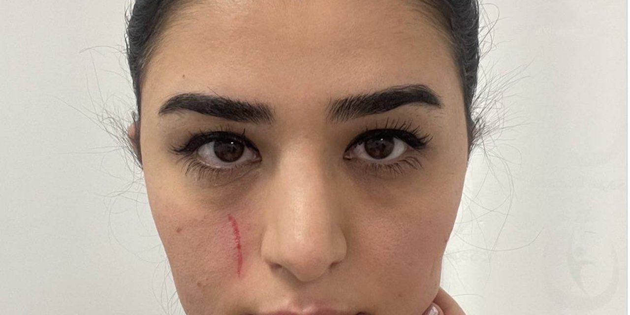 Bakanım Yılın İlk Sağlıkta Şiddet Olayını Da Yayınlayacak Mısınız ?