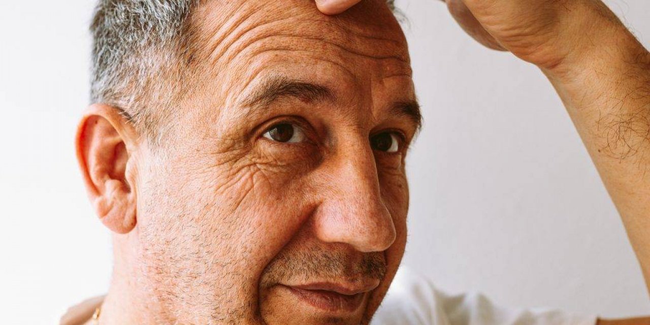 Saç Ekim Merkezlerine Sertifika Zorunluluğu Getirildi