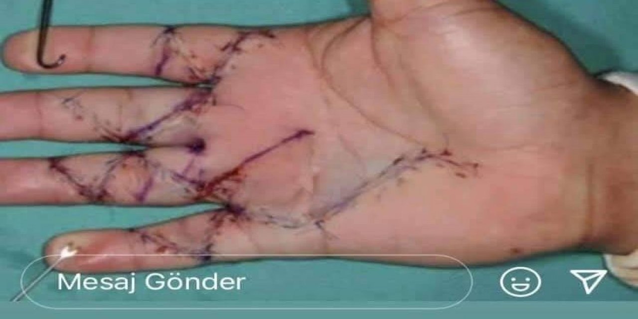 Yargıtay’dan ‘hekime Şiddet’ Davasında Emsal Karar!