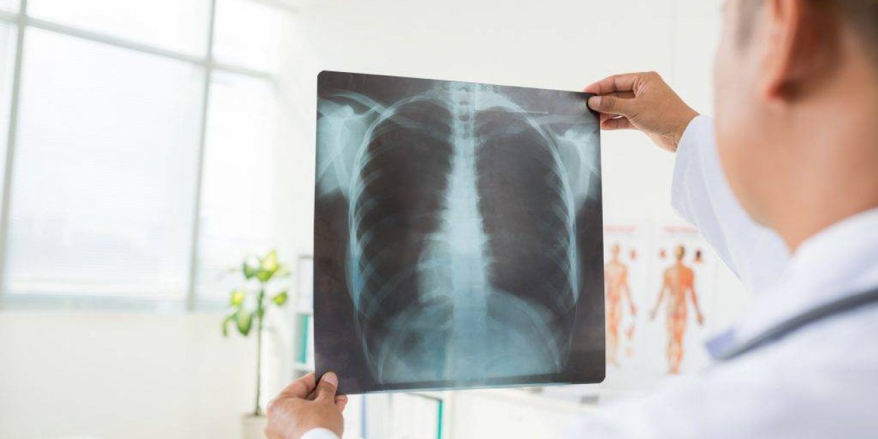 Akciğer Naklinde Nelere Dikkat Edilmeli?