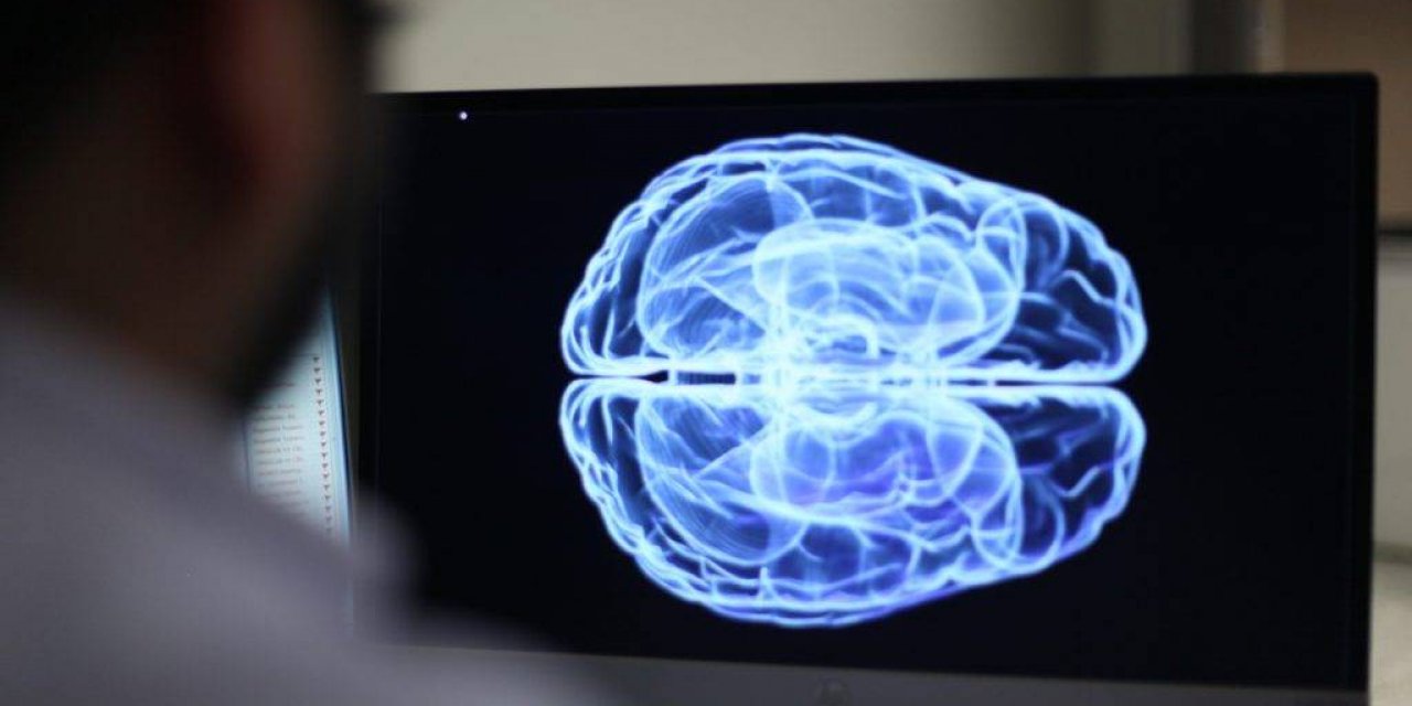 Beyin Çipi İlk Kez İnsanın Beynine Yerleştirildi !