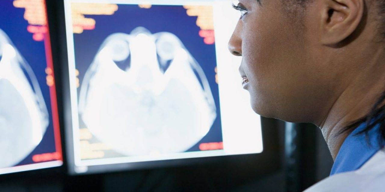 Anevrizma Nedir Ve Hangi Belirtilerle Kendini Gösterir?