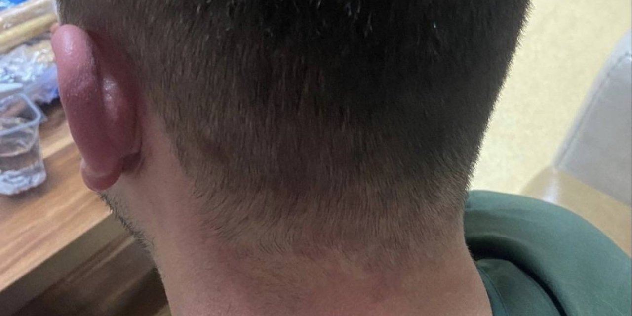 Şeker Bayramında Sağlık Personeli Darp Edildi ! 