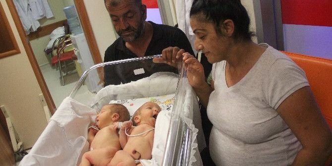 Hatay’da Yapışık İkizler Dünyaya Geldi