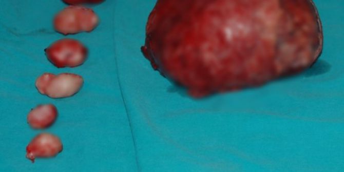 Rahminden 11 Tane Miyom Çıkarıldı