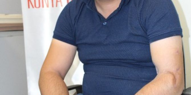 Yerine Dikilen Kolu Fizik Tedavi İle Çalışmaya Başladı