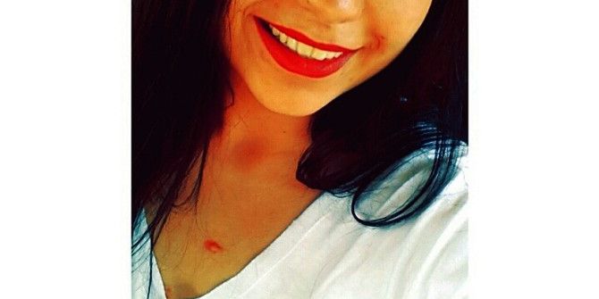 Üniversite Öğrencisi Kazada Öldü