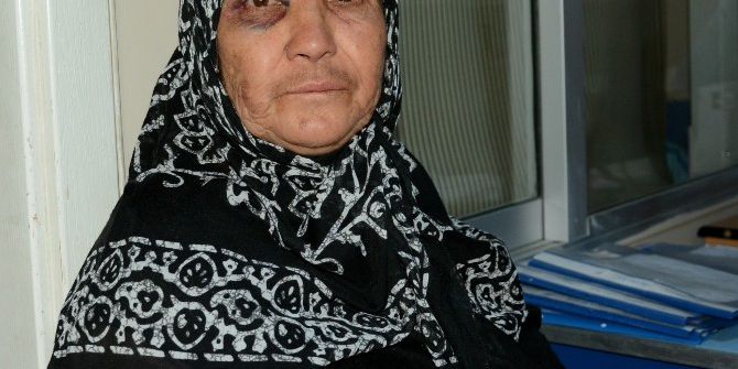 55 Yıllık Kocasından Dayak Yiyen Kadın Hastanelik Oldu