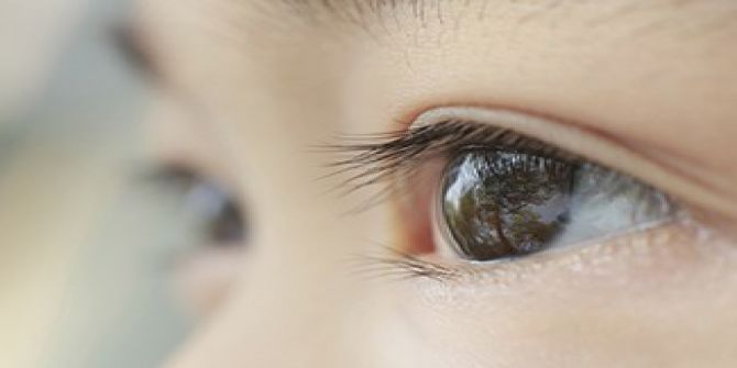 Kaybedilen Göze Yüz Güldürücü Tedavi: Göz Protezi