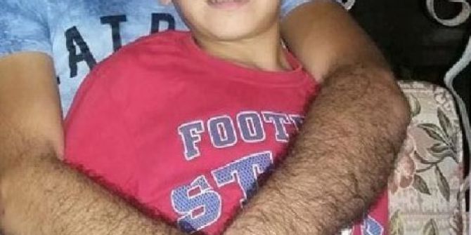 Küçük Berkay’ın Mezarlığını Savcı Belirledi