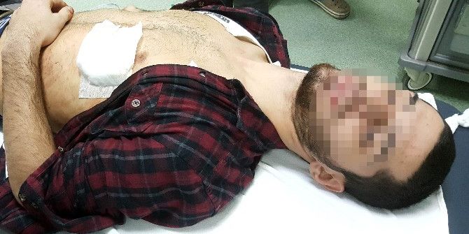 Bıçaklı Saldırıda Yaralandı