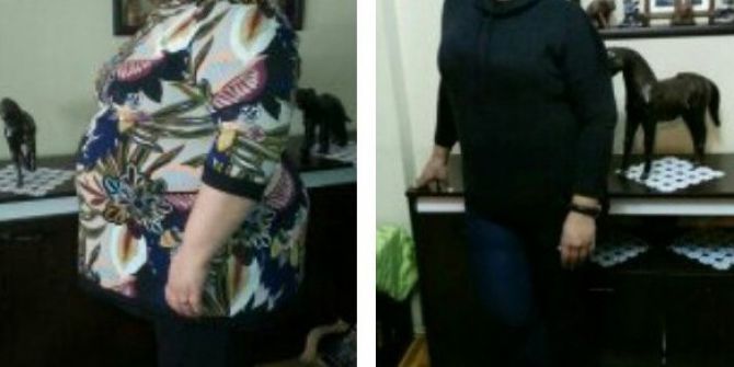 Ölümü Göze Alıp 1,5 Yılda 84 Kilo Verdi