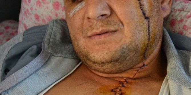 Çalınan Kamyonetini Ararken Bıçaklandı