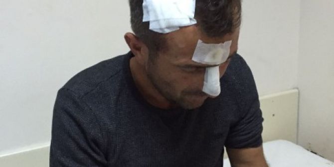 Yolda Yürürken Az Daha Ölüyordu