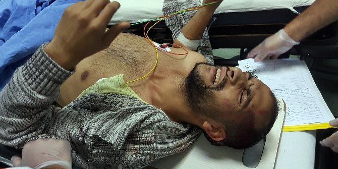 Çocuğunu Severken Silahlı Saldırıda Ağır Yaralandı